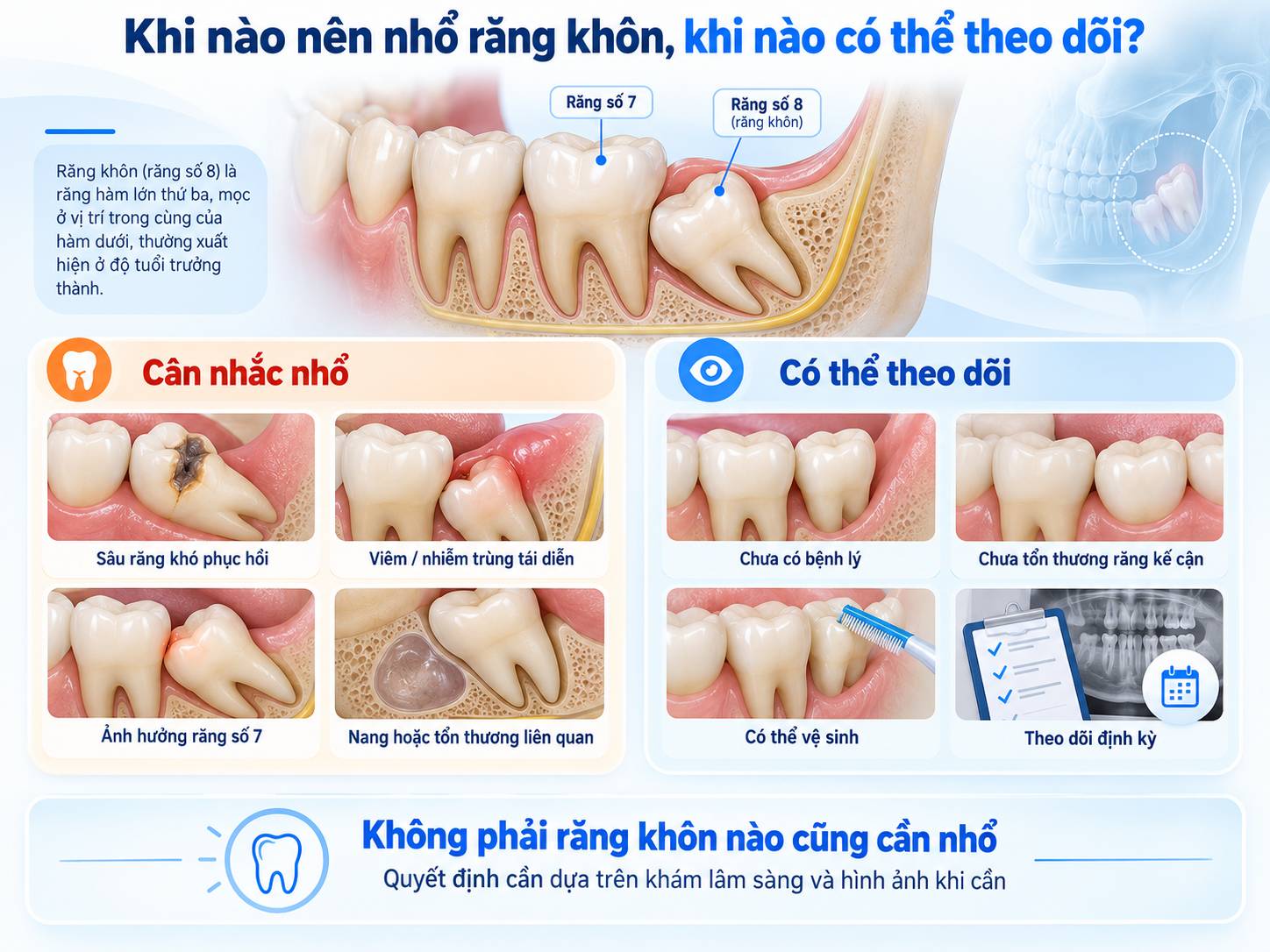 Các yếu tố giúp bác sĩ cân nhắc nhổ hoặc theo dõi răng khôn